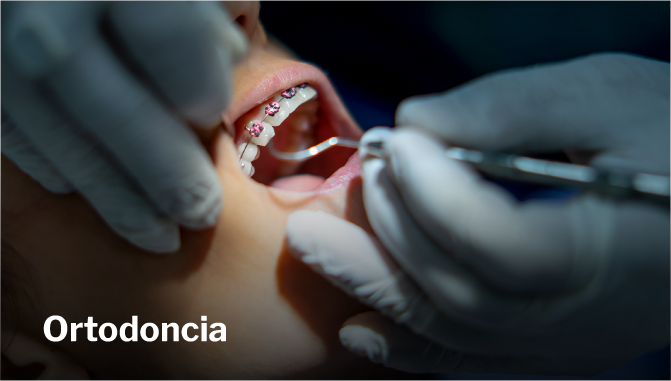 Ortodoncia Especialidades Odontológicas   Universidad Hemisferios Ortodoncia   Universidad Hemisferios